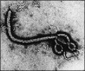 Krim-Congo-virus.jpg (18309 bytes)