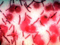 Miltbrand-bakterien.jpg (17367 bytes)