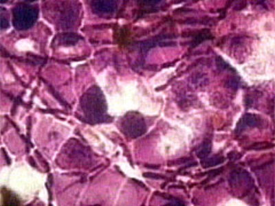 15oktMiltbrand400.jpg (34410 bytes)